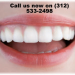 chicago teeth whitening