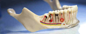 What Makes Root Canal Therapy Superb Today