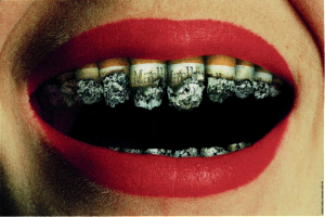 Prevent Tooth Loss by Quitting Smoking Habit