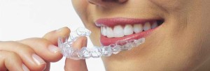 Bits of Info about Invisalign Treatment